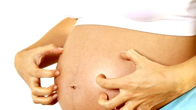 What is Gestational Cholestasis and How Is It Treated? What are the Symptoms of Pregnancy Cholestasis?