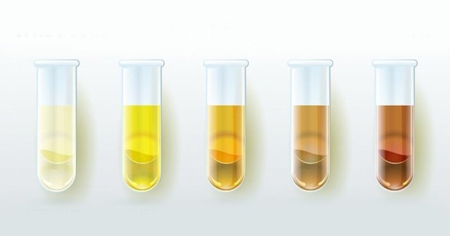 When Does Urine Color Change During Pregnancy? Can Gender Predictions Be Made From Urine Color?