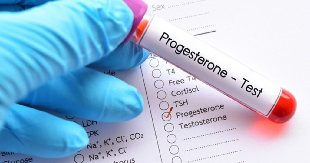 What is the Progesterone Hormone Level to Get Pregnant? What are the Symptoms of Low Progesterone During Pregnancy?